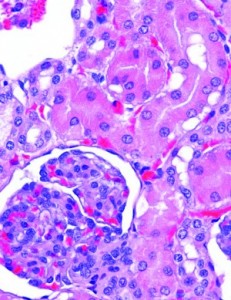 Kidney tissue with hematoxylin and eoslin (H&E) stain. Photo courtesy Ventana.